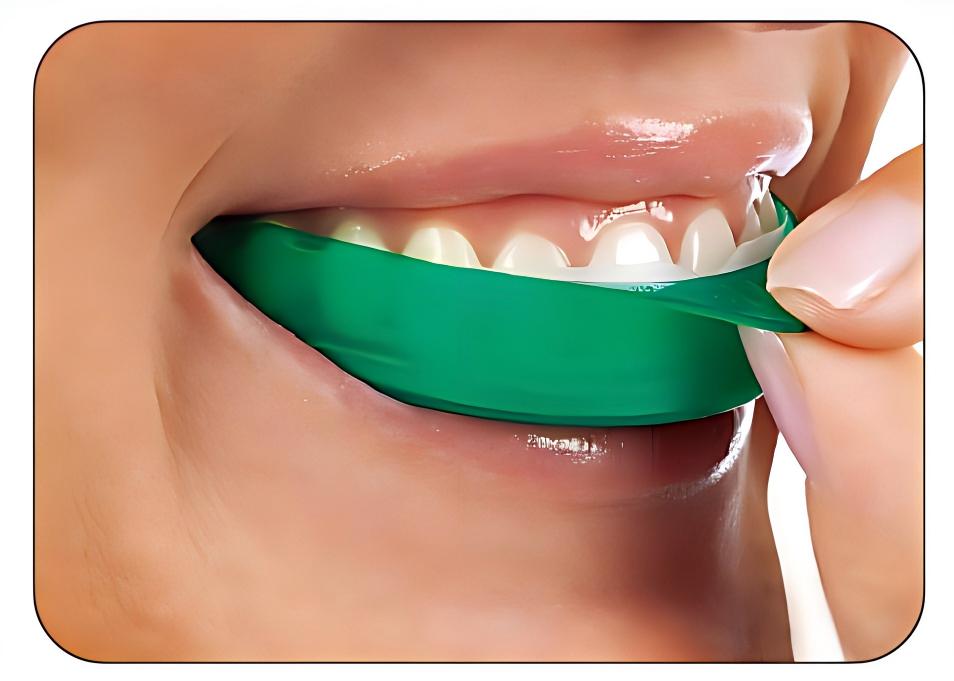 Ultradent Opalescence Go Teeth - Teeth Whitening Opalescence Go 评论和价格