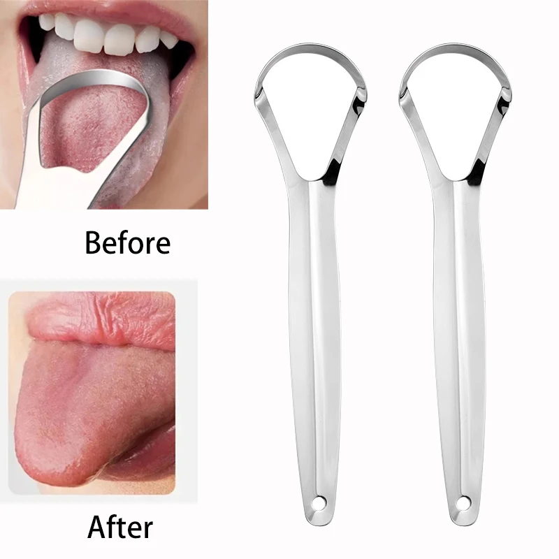 Halitosis Tongue Coating Tongu - Tongue Scraper Metal 评论和价格
