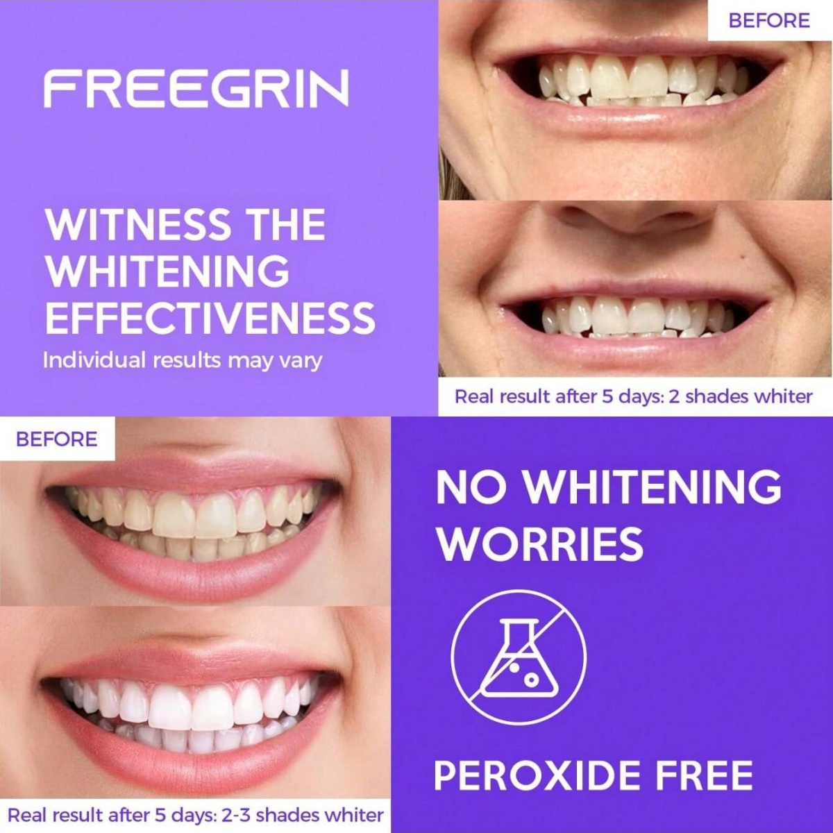 Deluxe Whitening Teeth Sticker - Teeth Whitening Essence 评论和价格