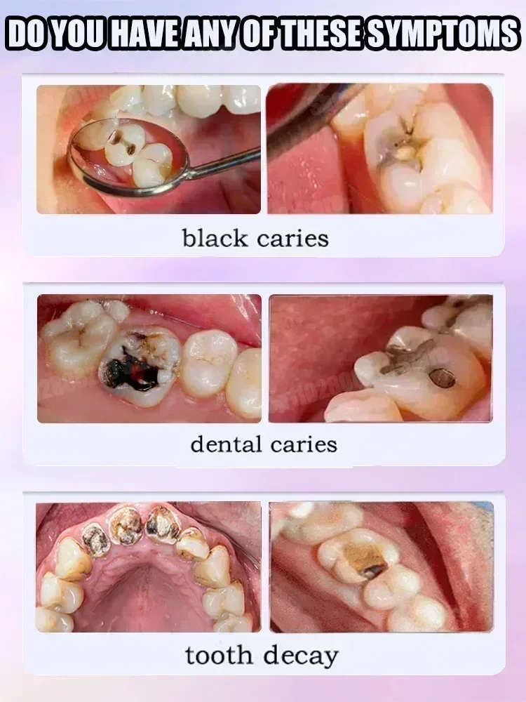 Teeth Cleaning Toothpaste Remo - Teeth Whitening Treatment 评论和价格
