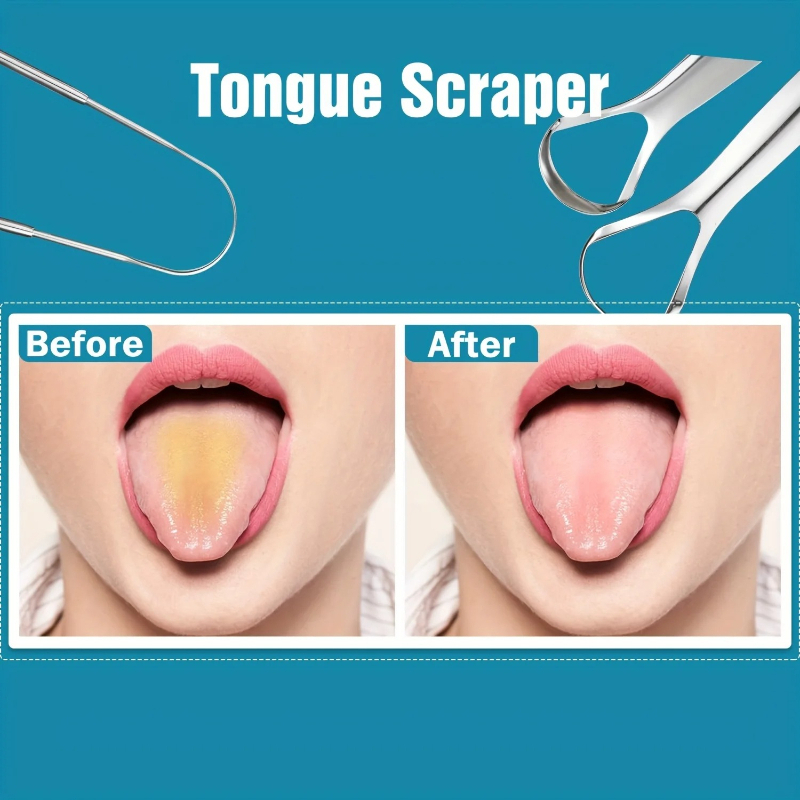 Stainless Steel Tongue Scraper - Tongue Scraper Metal 评论和价格
