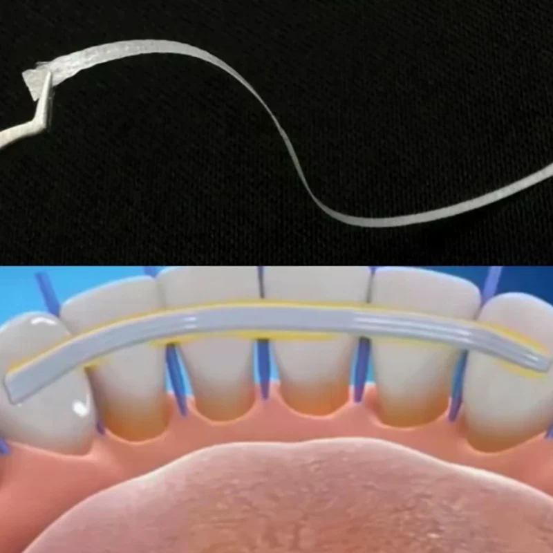 1Pc Dental Flexible Fiber Stri - Teeth Whitening Strips Lumineux 评论和价格